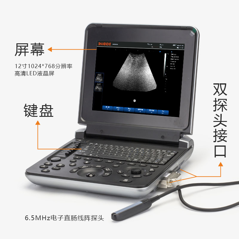 高清笔记本超声S30