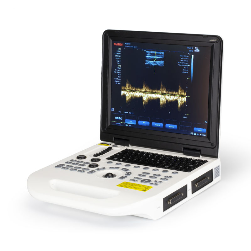 笔记本超声P30